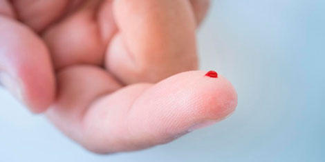 Как сдавать кровь из пальца – натощак или нет