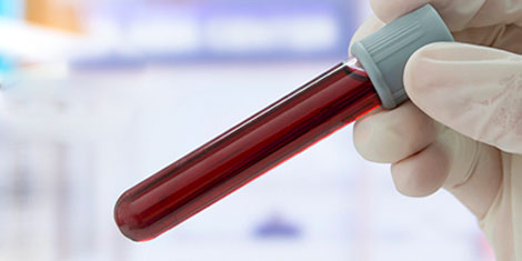 Общий и химический анализ крови на витамины
